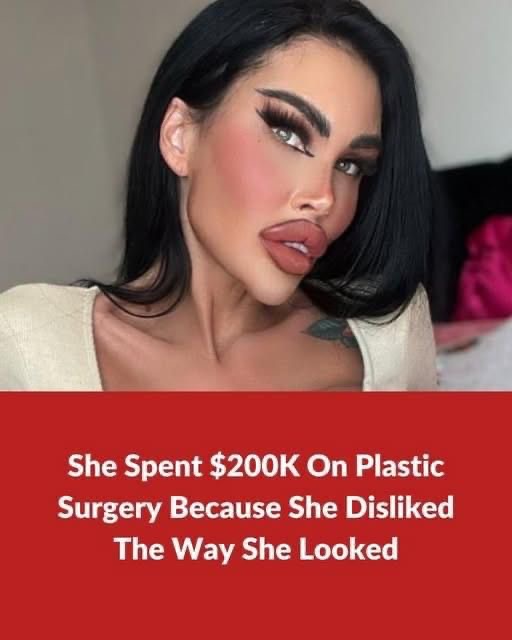 The Never-Ending Search for Perfection: A Woman’s Experience with Plastic Surgery
