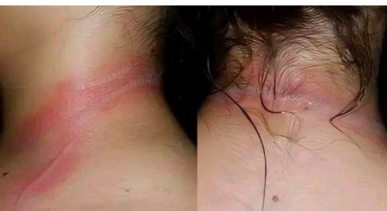 Mother horrified when daughter suddenly cries out in pain. Then she learns the cause