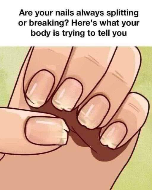 Are your nails always splitting or?