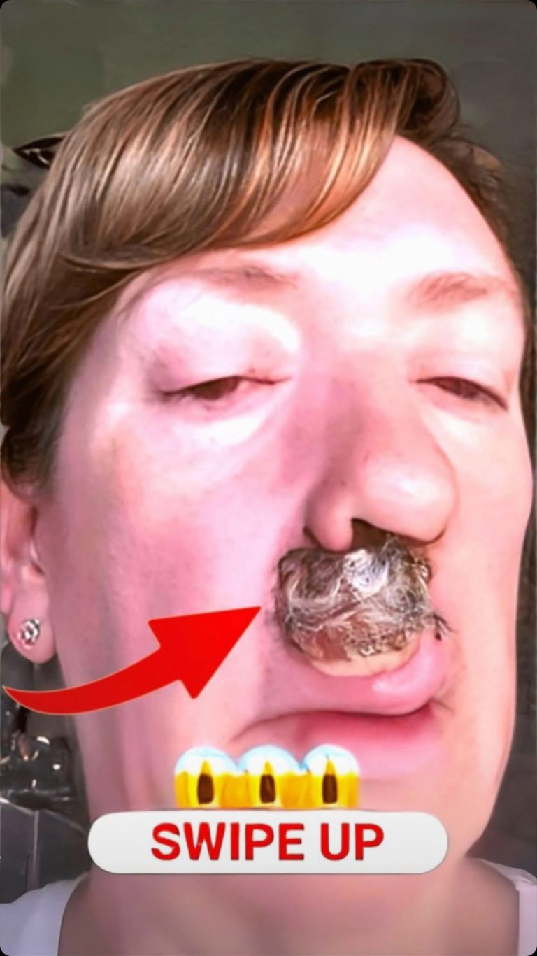 SERIOUS Diseases Diagnosed Via Skin Signals!