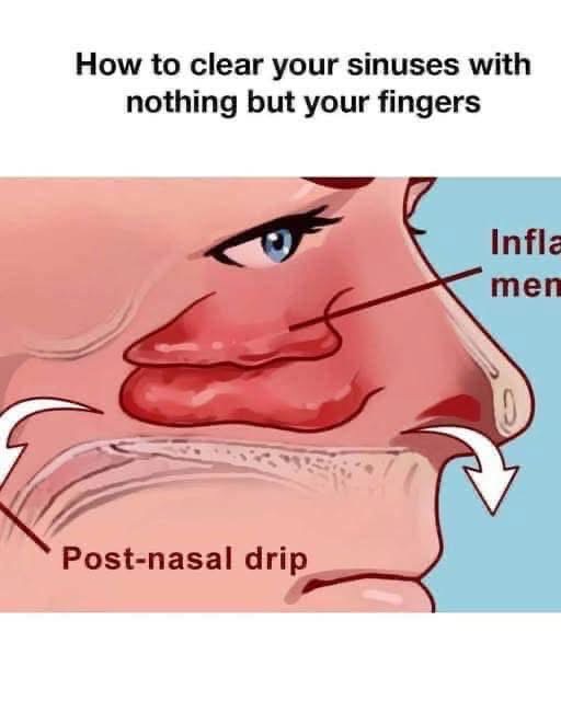 How to clear your sinuses in