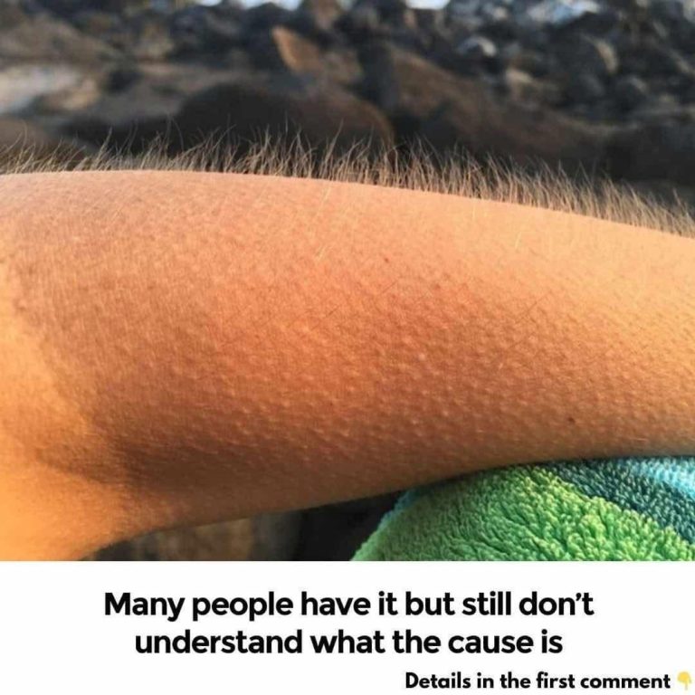 What causes us to get