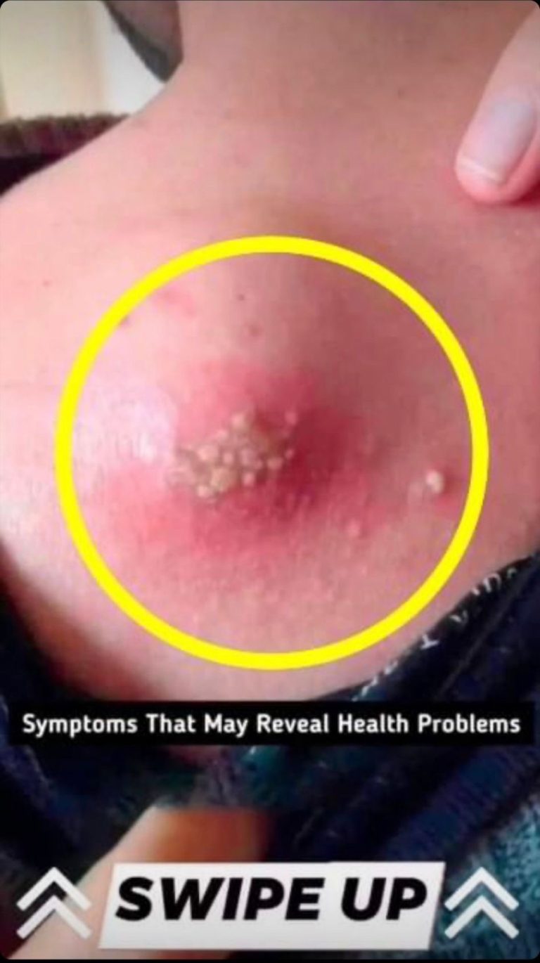 Body Alerts For Possible Health Issues..