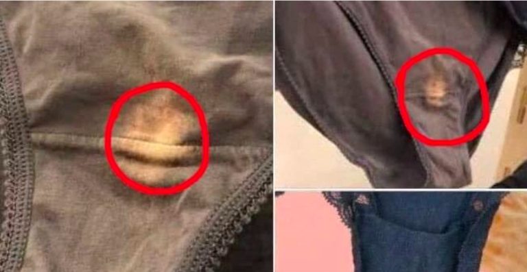 This is what it means if you find a “bleach” spot on your underwear!!!