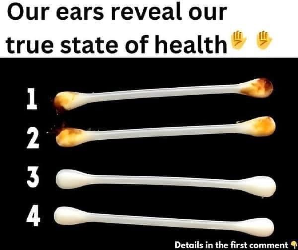 -Our ears reveal our true state of health-