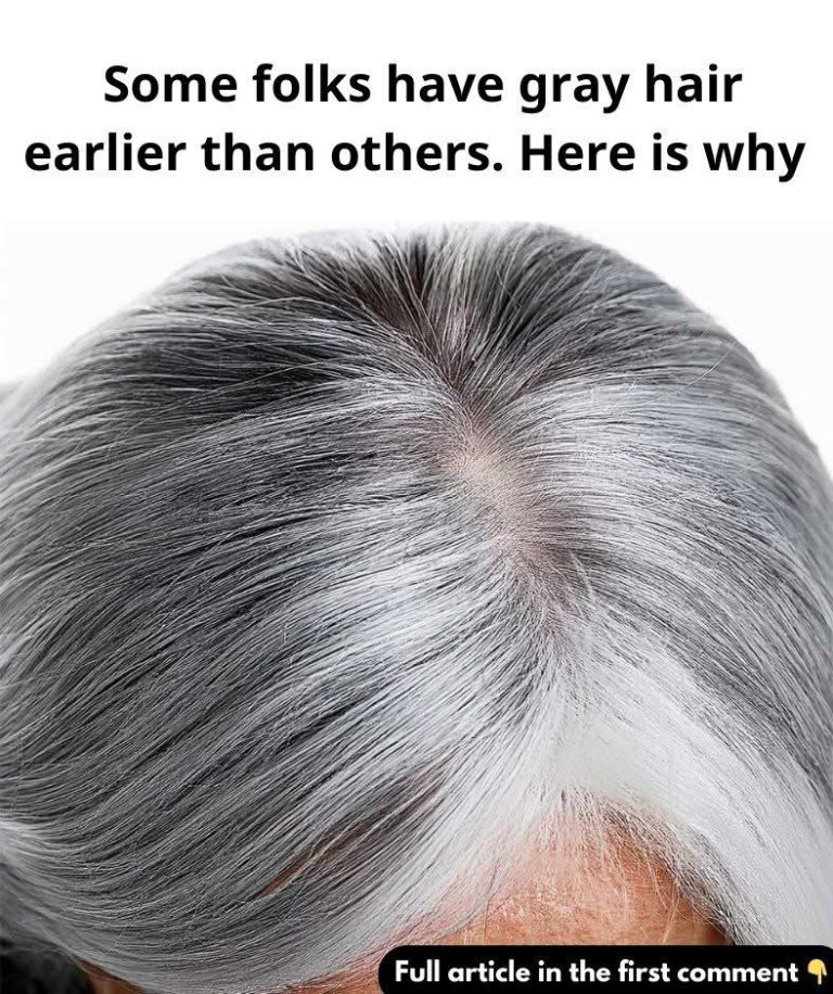 Gray hair shows up earlier for some individuals than for others. Here’s the reason!!