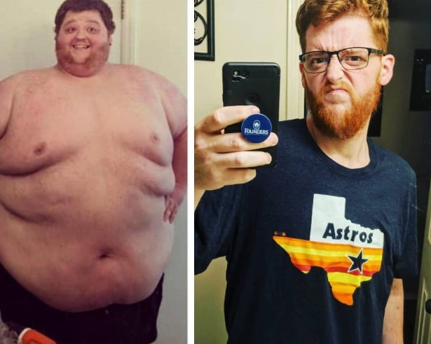 A 27-Year-Old Who Weighed 680 lbs Shed 490 lbs And Transformed !