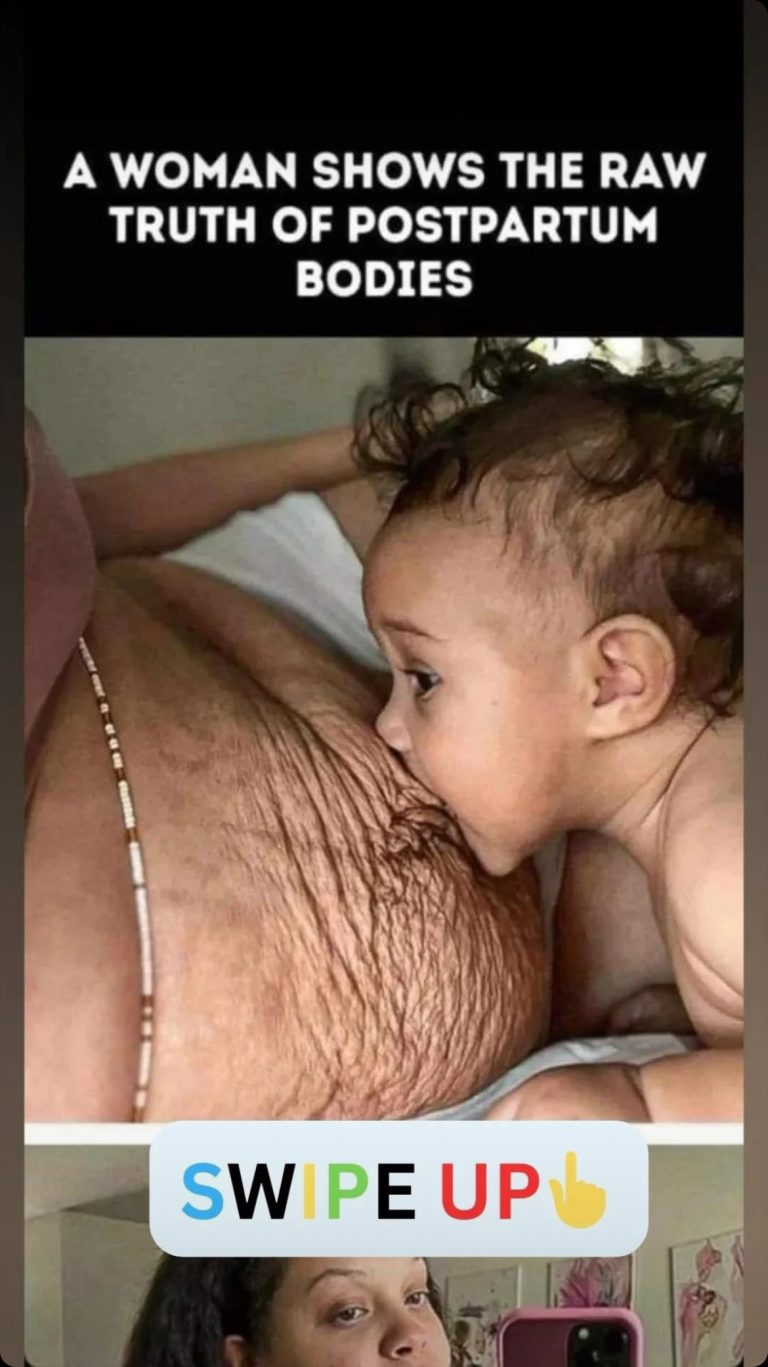 Woman Shares the Honest Reality of Postpartum Bodies!