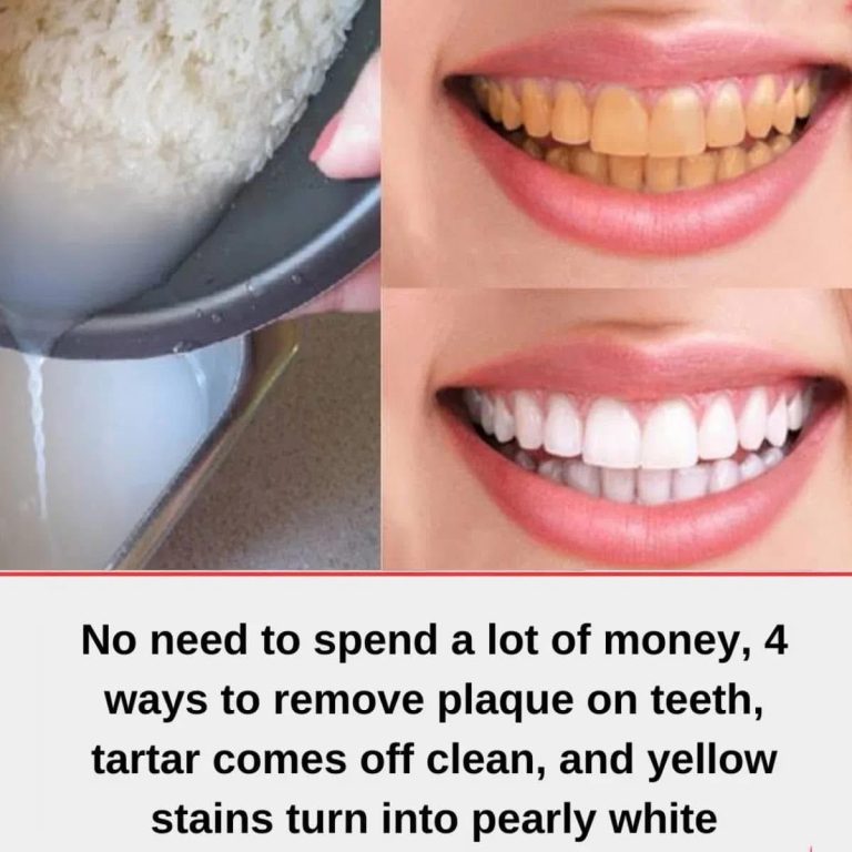 Don’t waste money on the dentist anymore!