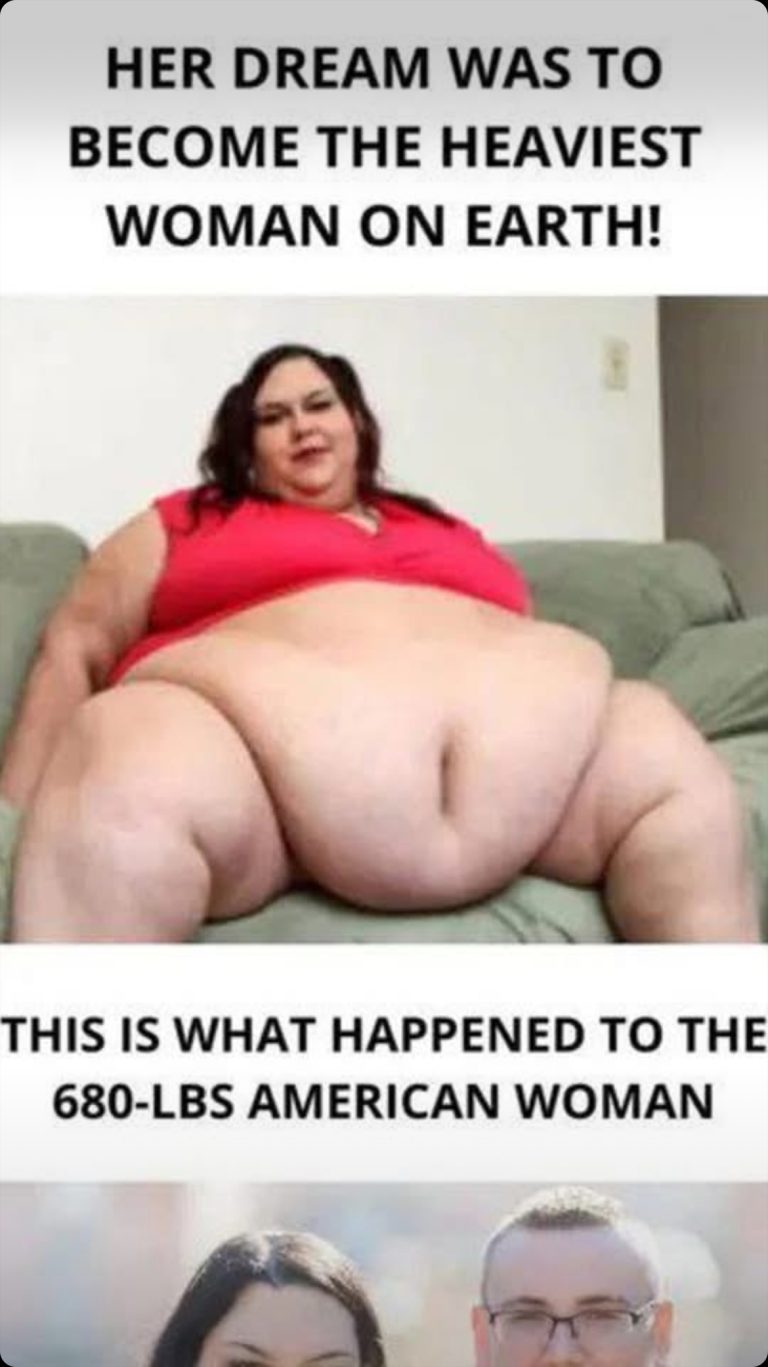 A 27-Year-Old Who Weighed 680 lbs Shed 490 lbs And Transformed !!