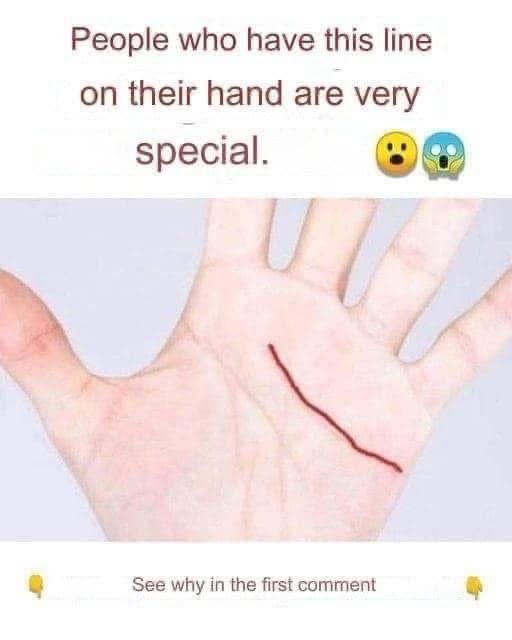 People who have this line on their