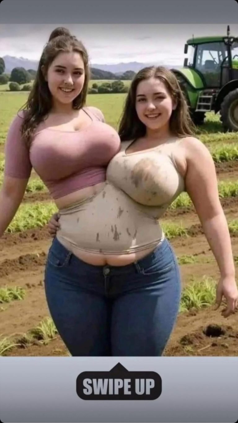 Conjoined Twins: United by the