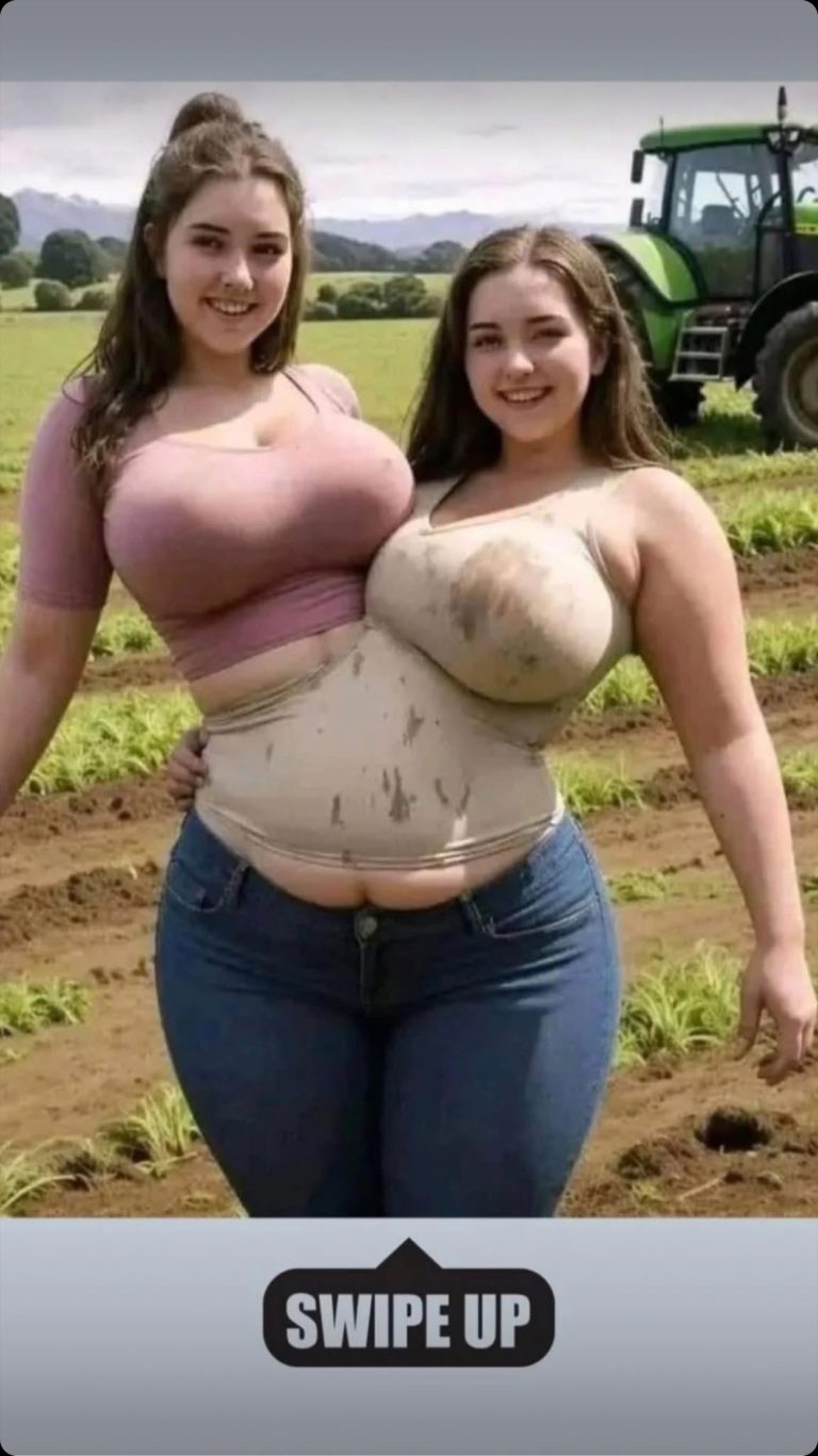 Conjoined Twins: United by the Hips, Separated by the Heart