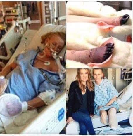 Her Legs Are am’putated After Using a Common…