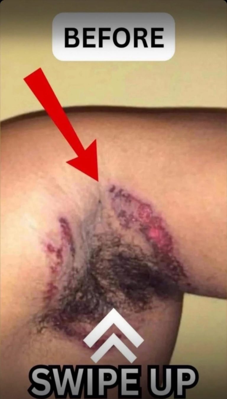 What Causes this..