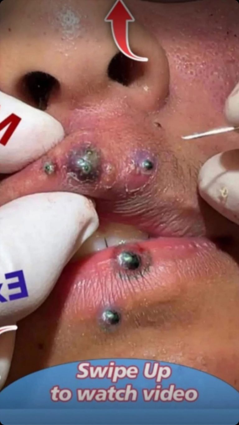 Seven Things That Clog Your Pores