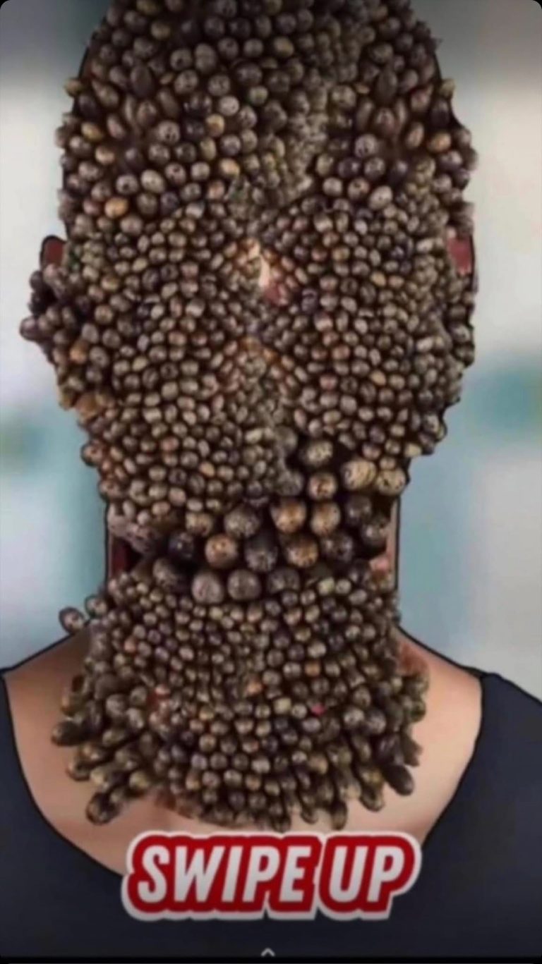 7 Tips to Get Rid of Body Acne