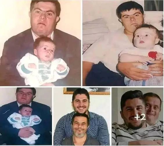 A father with Down syndrome raised his son, who is
