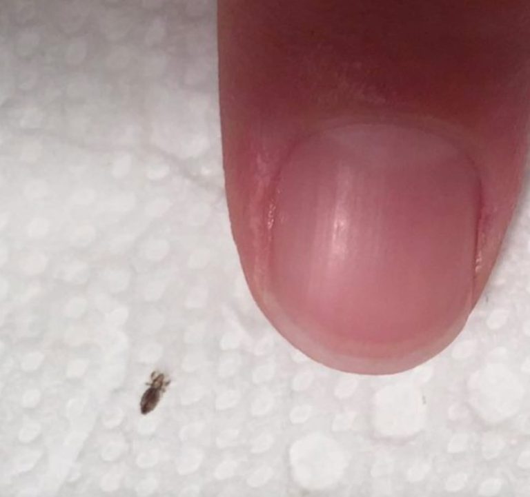 If you find this bug in your hair,