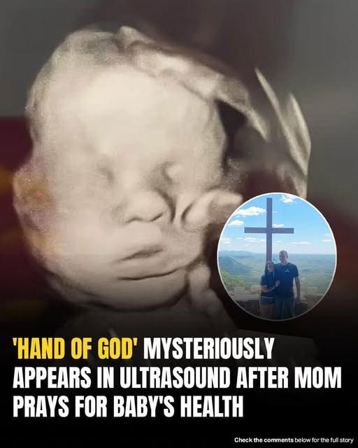 Mom spots ‘God’s hand’ cradling baby’s head in ultrasound