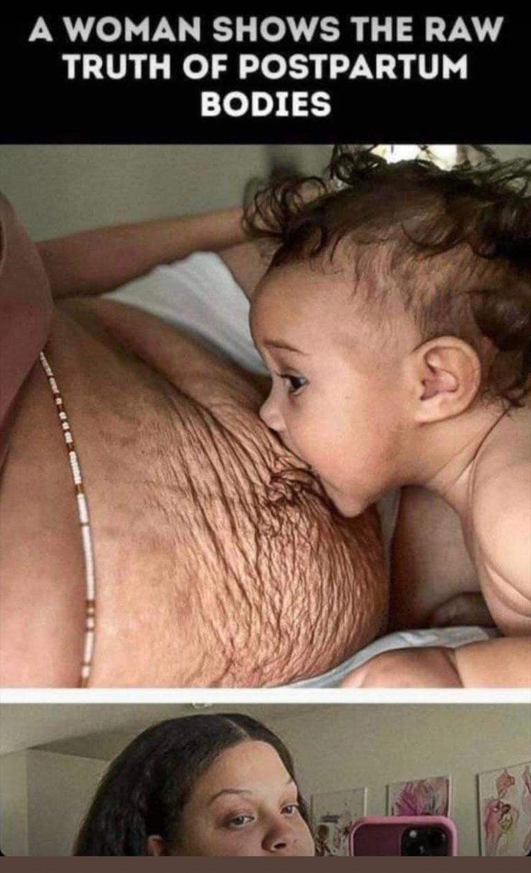 WOMAN Shows the Raw Truth of Postpartum Bodies