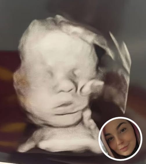 Pregnant Woman Hopes for a Healthy Baby, Amazed by Ultrasound Details