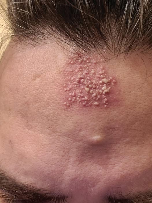 These are the consequences of sleeping with