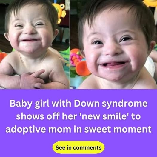 Smiling baby born with Down syndrome touches hearts across the globe.