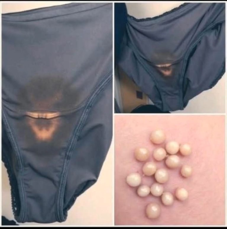 BE CAREFUL, if you notice this in your underwear,
