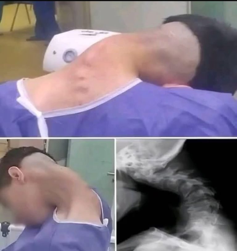 Girl was hospitalized