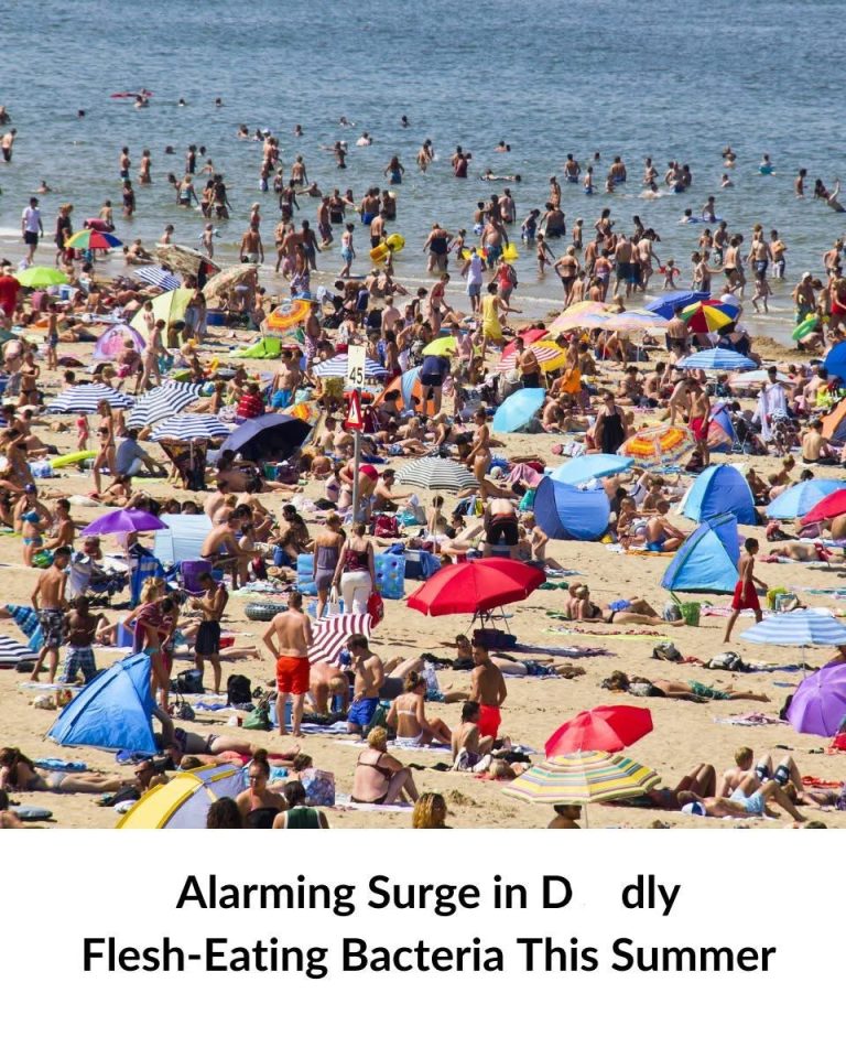 Flesh-Eating Bacteria Cases Are Rising, How To Protect Yourself