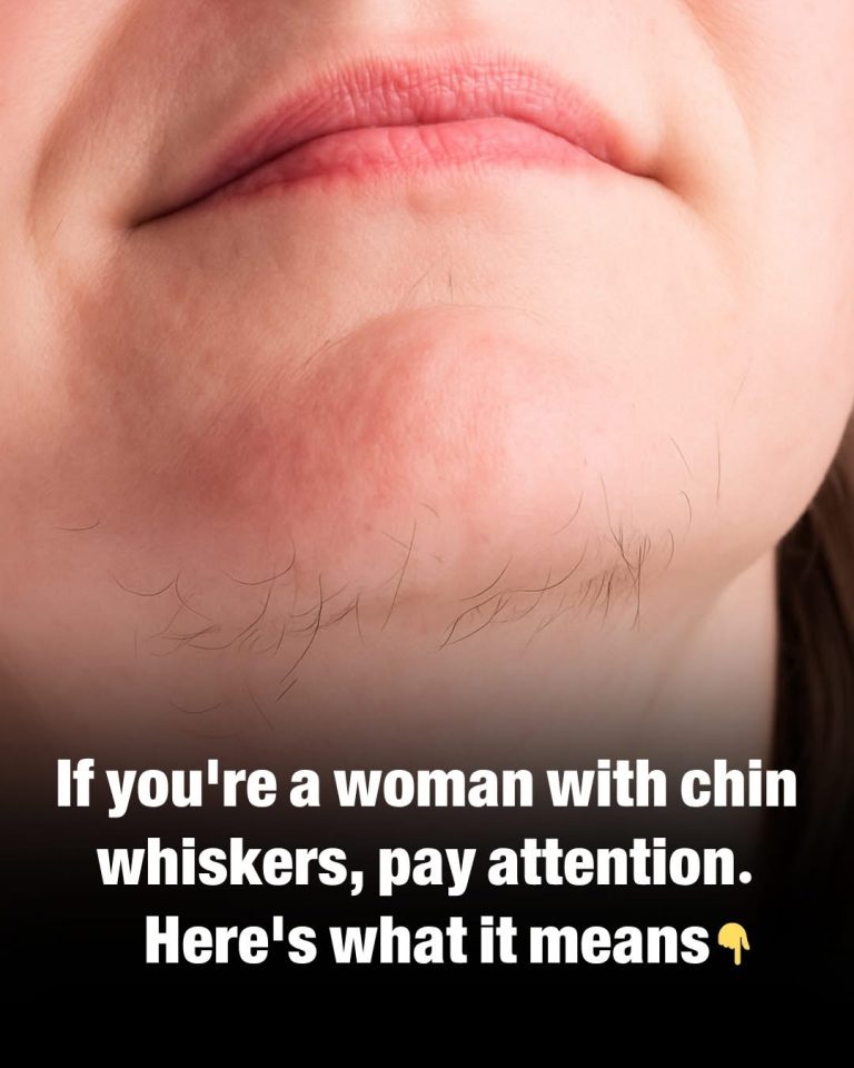 What Chin Whiskers Might Tell You About Your Health