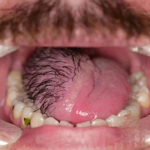These are the consequences of sleeping with