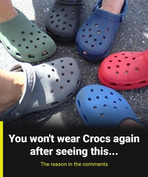 I thought crocs were harmless… but what I discovered about them sh0cked me…..