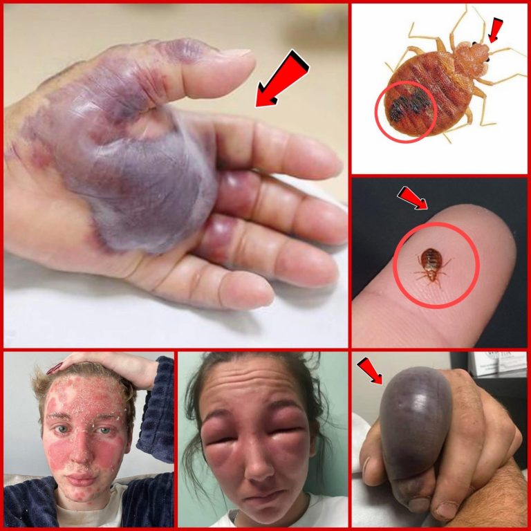 ATTENTION to these first signs of…i