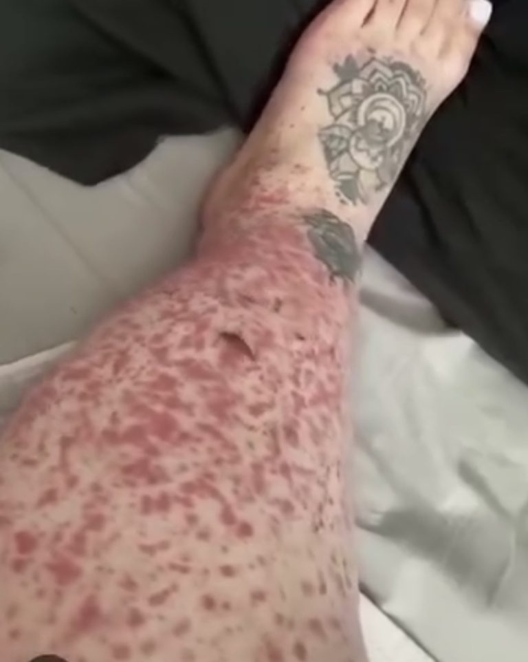 These are the consequences of sleeping with