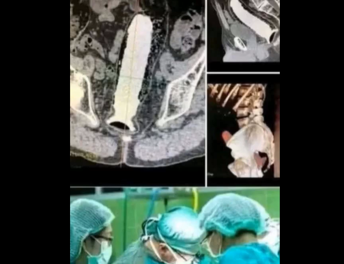 Girl was hospitalized