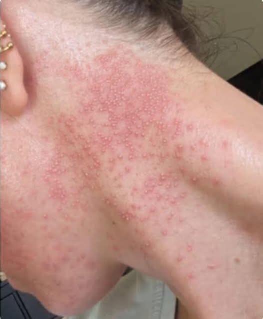 These are the consequences of eating …See more