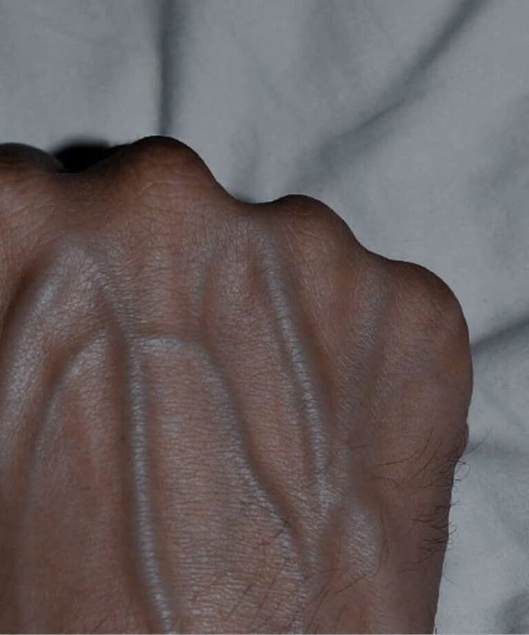 If your veins are visible in your hand, it is a signal of ca