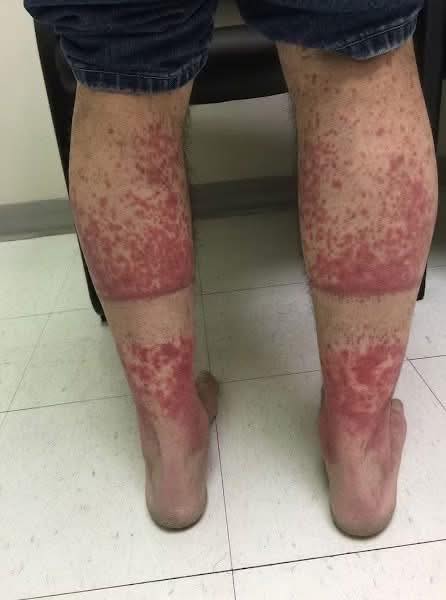 These are the consequences of sleeping with…