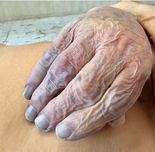 Women who have hands…