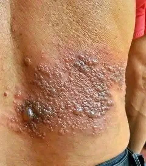 Young woman dies at the hands of her…
