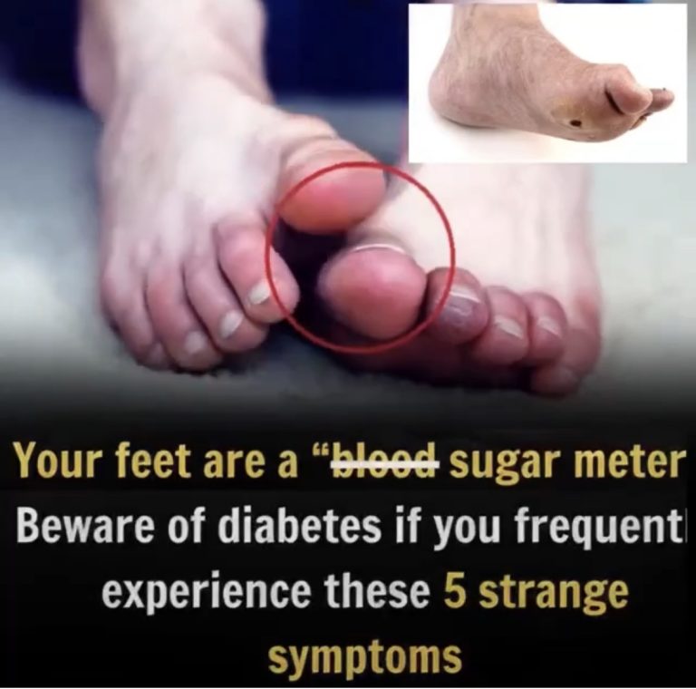 Here are five unusual foot symptoms