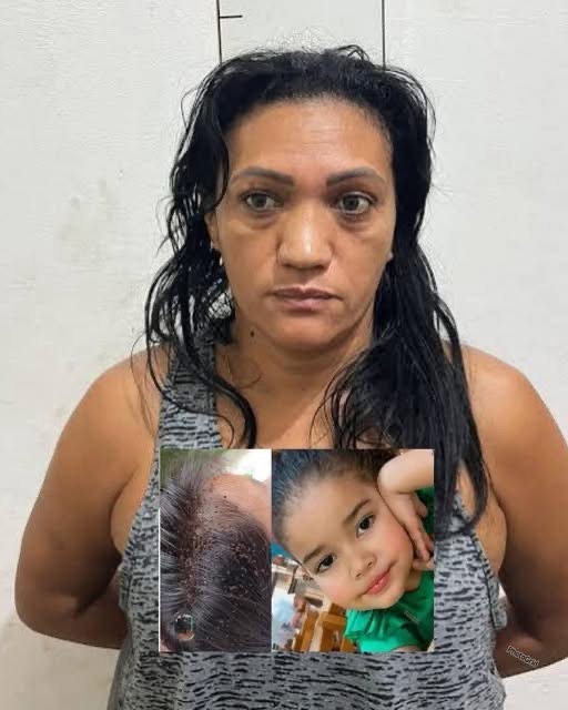 3-year-old girl passed away after lice and mother warns