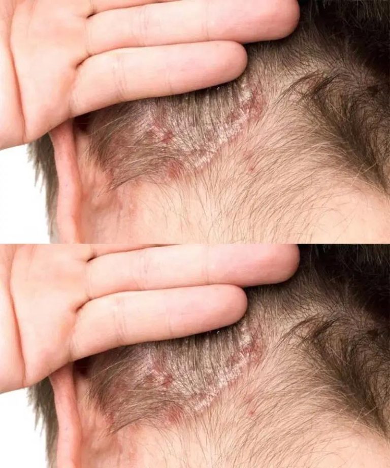 I found this on my son’s scalp and have no idea what it is. We can’t get a doctor’s appointment anytime soon—any advice?