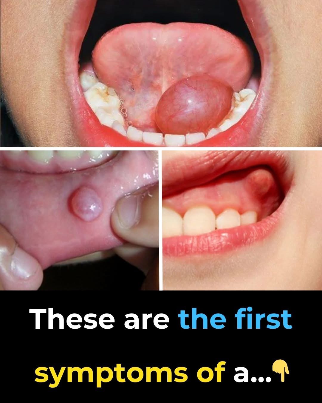 Hidden Dangers in Your Mout