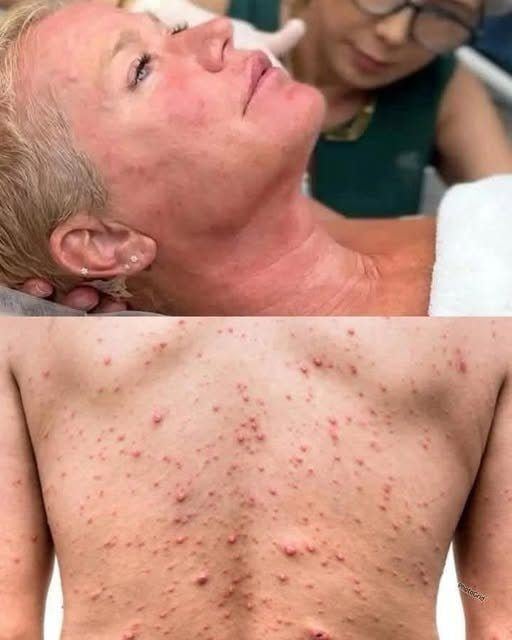 These are the consequences of sleeping coโฆ