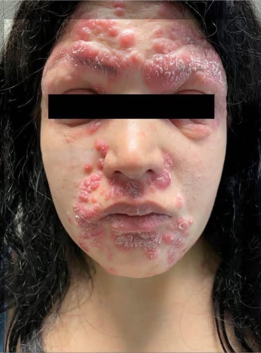 These are the consequences of sleeping withโฆ