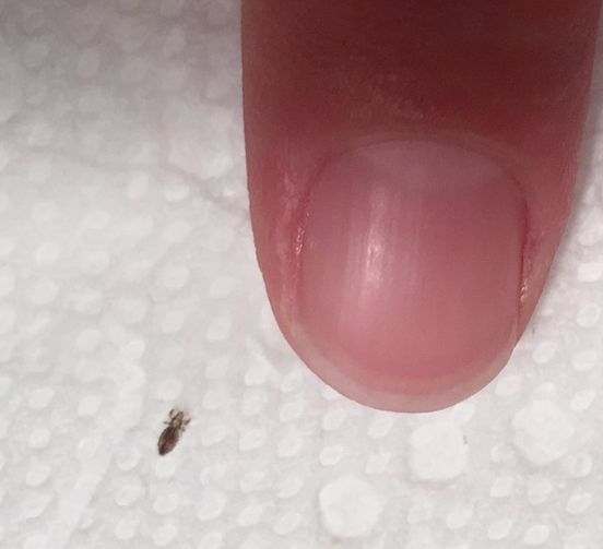 If you find this bug in your hair. How to get rid of them and stop them coming back
