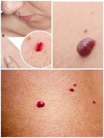 If you notice small red dots on your skin, they can signal many things